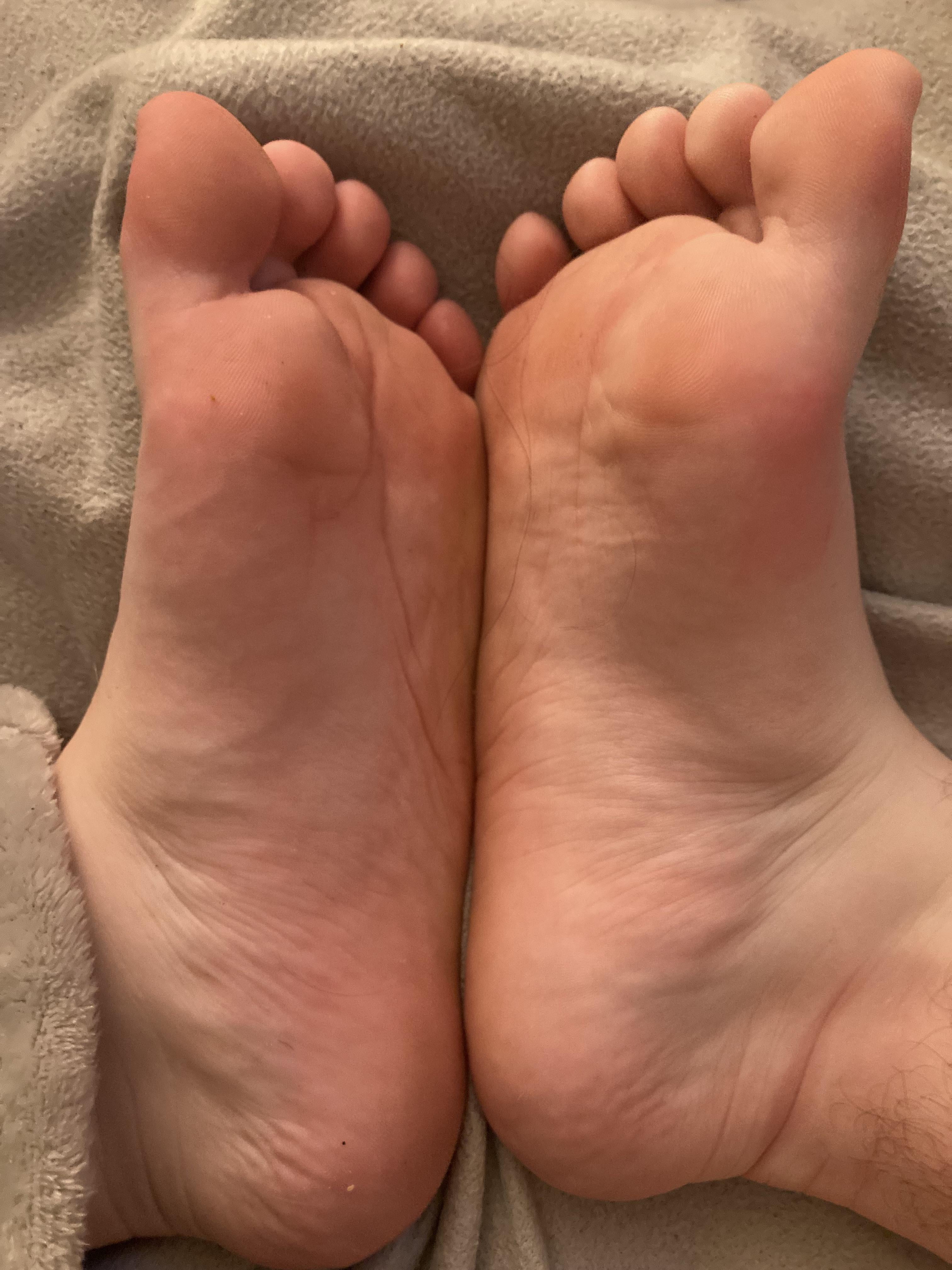 My feet are so swollen… i need them fem for